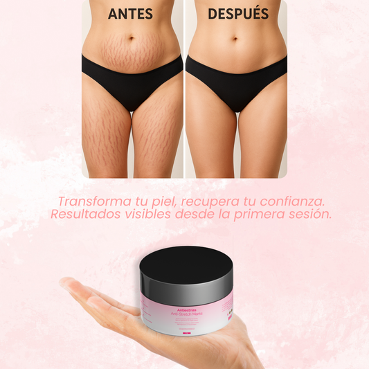 Crema Antistretch | Essenza™